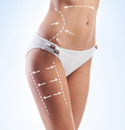 Chirurgo plastico liposuzione a Milano